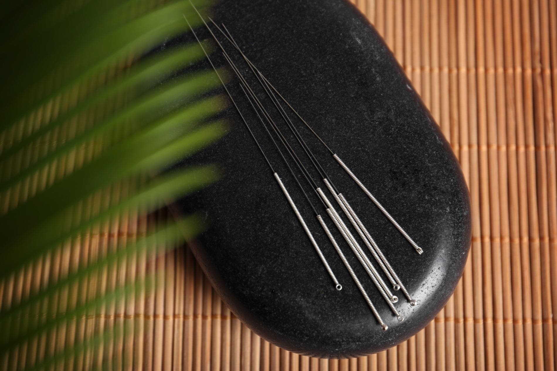 acupunctuur rotterdam rijnmond