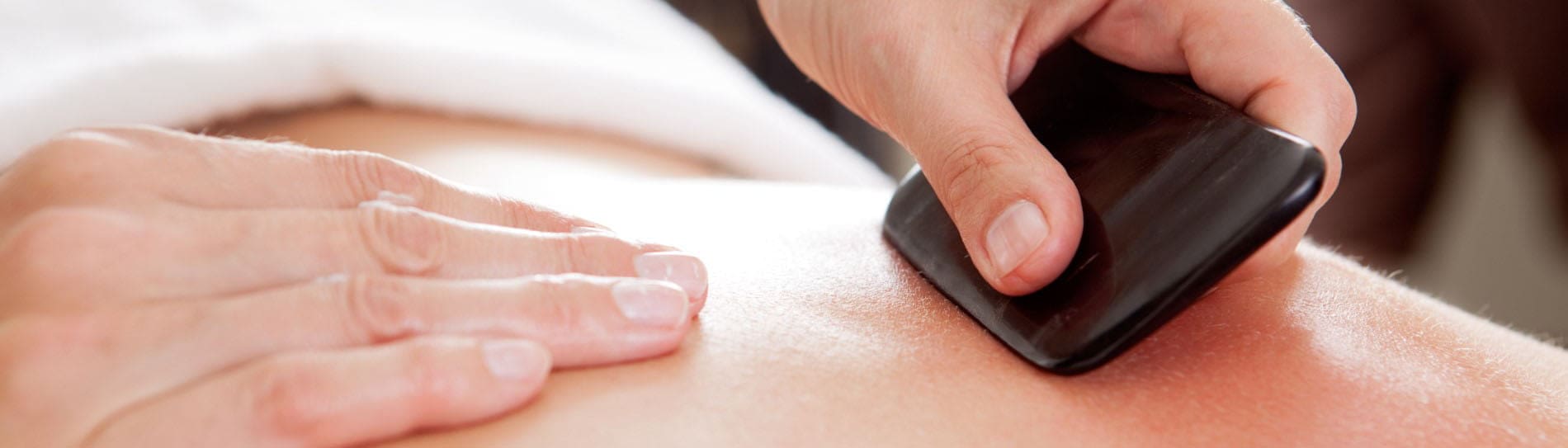 behandelingen acupunctuur rotterdam rijnmond